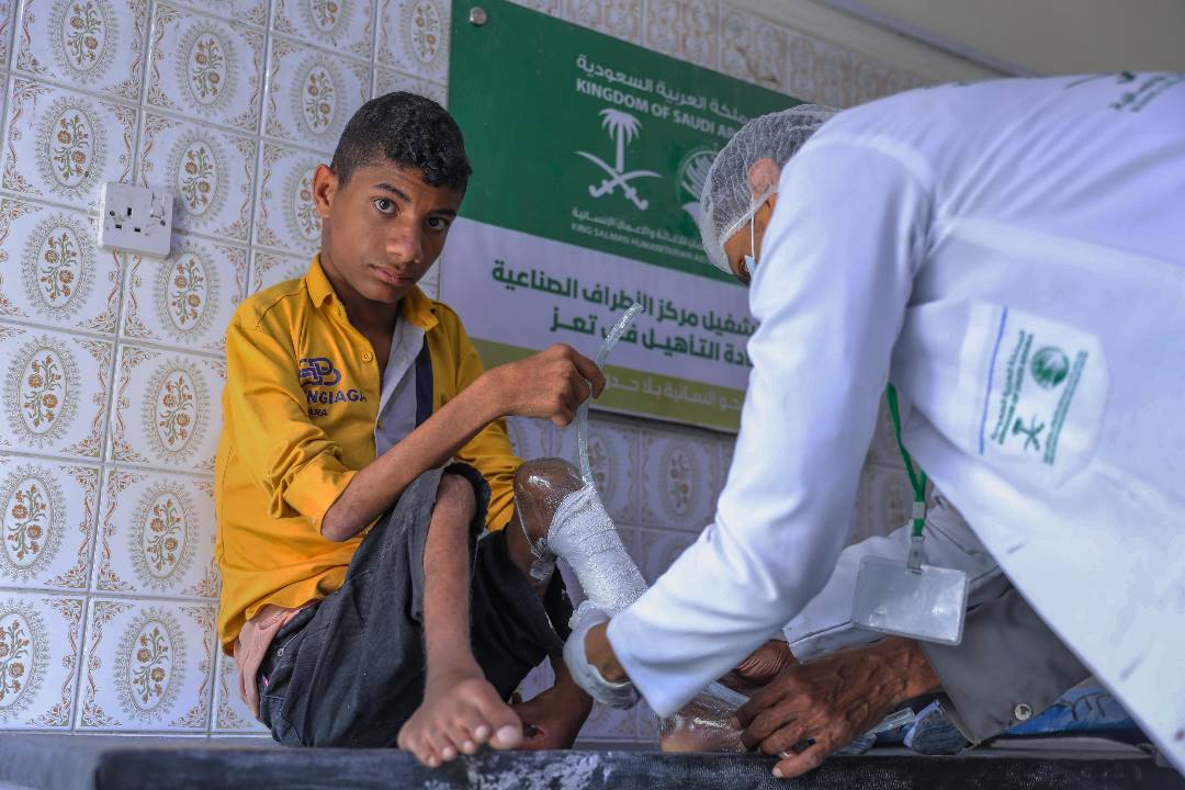 مركز الملك سلمان يستمر بدعم وتمويل مشاريع الأطراف الصناعية في اليمن 