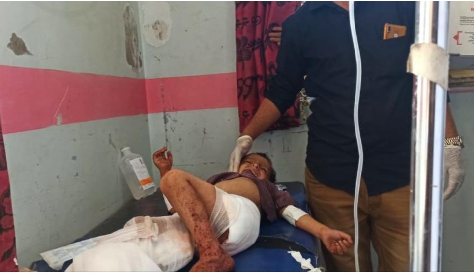 استشهاد 3 أطفال في قصف حوثي على أحد الأحياء السكنية في مدينة تعز
