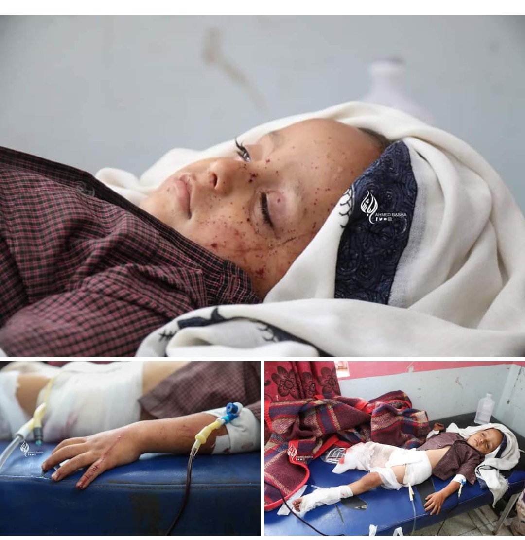 الوزير ‏الارياني يدين مجزرة مليشيا الحوثي في حي الكمب بمدينة تعز